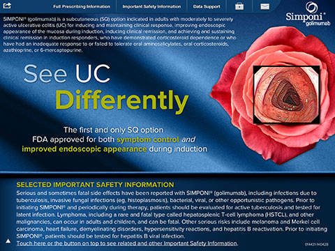 Simponi GI iPad app